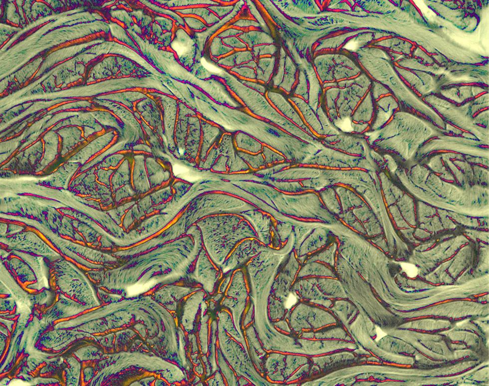 Collagen Forest - Sonya James